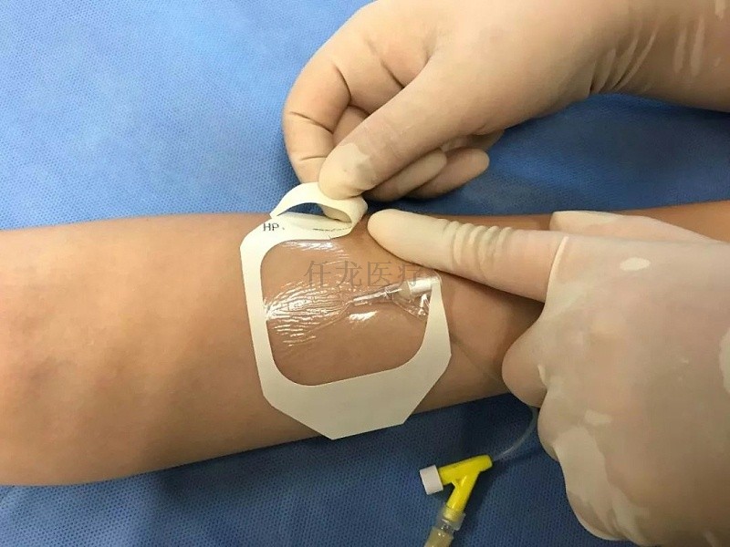 留置針的常見并發癥要怎么預防
